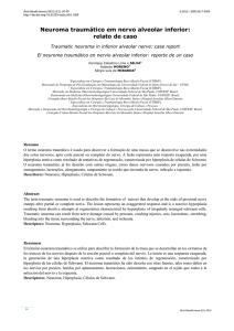 Neuroma traumático em nervo alveolar inferior: relato de caso