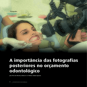 A importância das fotografias posteriores no orçamento odontológico