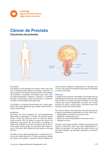 Câncer de Próstata - Carcinoma de próstata