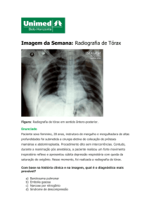 Imagem da Semana: Radiografia de Tórax - Unimed-BH