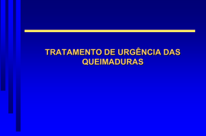 TRATAMENTO SISTÊMICO - LOCAL queimaduras