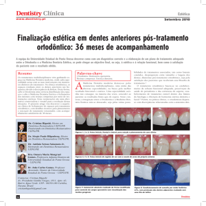 Finalização estética em dentes anteriores pós