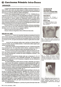 €) Carcinoma Primário Inlra