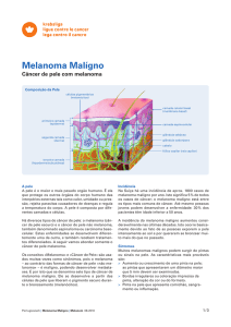 Melanoma Malígno - Câncer de pele com melanoma