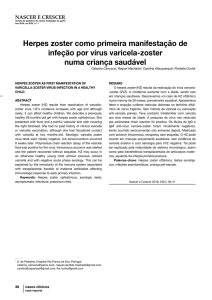 Herpes zoster como primeira manifestação de infeção por vírus