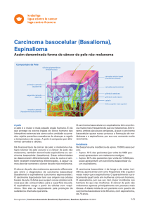 Carcinoma basocelular (Basalioma), Espinalioma