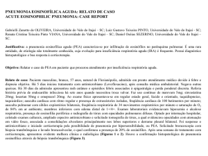 pneumonia eosinofílica aguda - 13º Congresso Brasileiro de Clinica