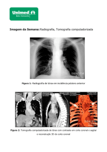 Imagem da Semana:Radiografia, Tomografia - Unimed-BH