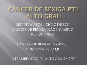 CÂNCER DE BEXIGA Pt1 ALTO GRAU