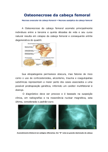 Osteonecrose da cabeça femoral