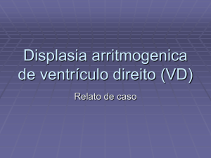 Displasia arritmogenica de ventrículo direito