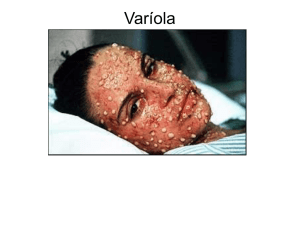 Varíola - marechalrondon