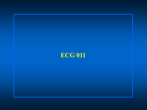 Slide 1 - ECG Cardio