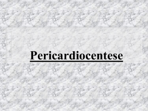 Pericardiocentese