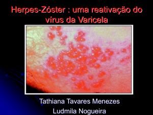 Herpes - Zóster: Uma Reativação do Vírus da Varicela.