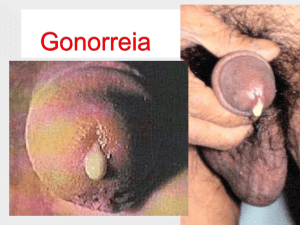 Gonorreia - Sem Preconceitos