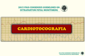 cardiotocografia 2015 figo consensus guidelines on intrapartum