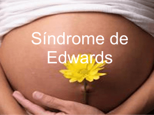 Síndrome de edwards