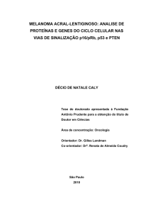 MELANOMA ACRAL-LENTIGINOSO: ANALISE DE PROTEÍNAS E