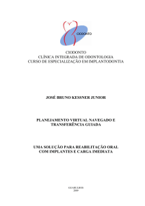 Planejamento Virtual Navegado e Transferência Guiada.