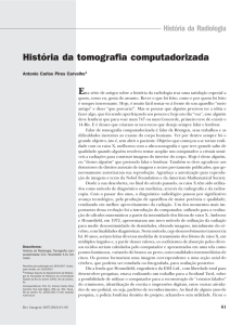 História da tomografia computadorizada