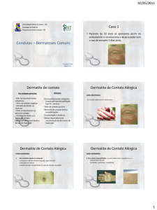 Condutas – Dermatoses Comuns - Universidade Federal do Ceará