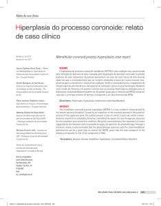 Hiperplasia do processo coronoide: relato de caso