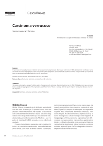 Carcinoma verrucoso