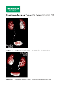 Imagem da Semana:Tomografia Computadorizada (TC) - Unimed-BH