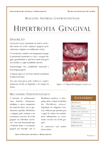 hipertrofia gengival - Universidade de Lisboa