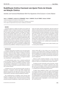 Reabilitação Estética-Funcional com Ajuste Prévio da Oclusão em