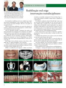 Reabilitação oral exige intervenções transdisciplinares - Bio-Art