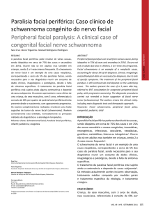 Paralisia facial periférica