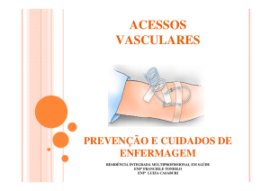 acessos vasculares