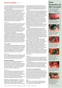 - Community Eye Health Journal