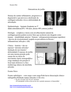 Osteoartrose do joelho Doença de caráter inflamatório, progressivo