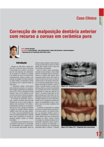 Correcção de malposição dentária anterior com recurso a coroas