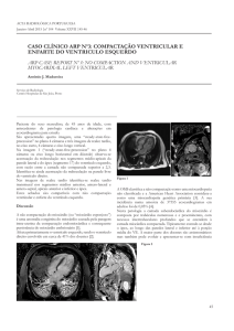 caso clínico arp nº3: compactação ventricular e enfarte do ventriculo