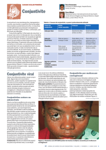 Conjuntivite - Community Eye Health Journal