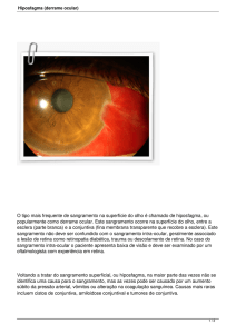 Hiposfagma (derrame ocular)