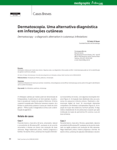 Dermatoscopia. Uma alternativa diagnóstica em
