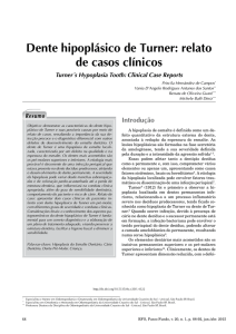 Dente hipoplásico de Turner: relato de casos clínicos Turner´s