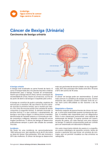 Câncer de Bexiga (Urinária)