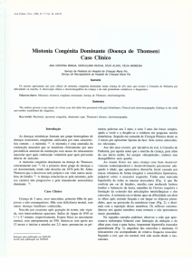 Miotonia Congénita Dominante (Doença de Thomsen) Caso Clínico