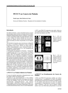 PET CT