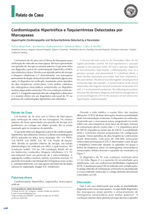 Cardiomiopatia Hipertrófica e Taquiarritmias Detectadas por