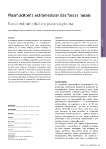 Plasmocitoma extramedular das fossas nasais Nasal extramedullary