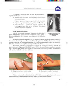 Os resultados das radiografias de tórax deverão obedecer