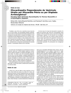 Miocardiopatia Preponderante de Ventrículo Direito por Miocardite