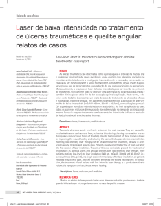 Laser de baixa intensidade no tratamento de úlceras traumáticas e